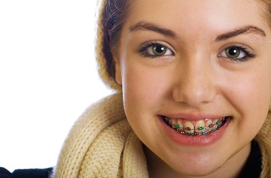 Read This Before Your Kid Gets Braces