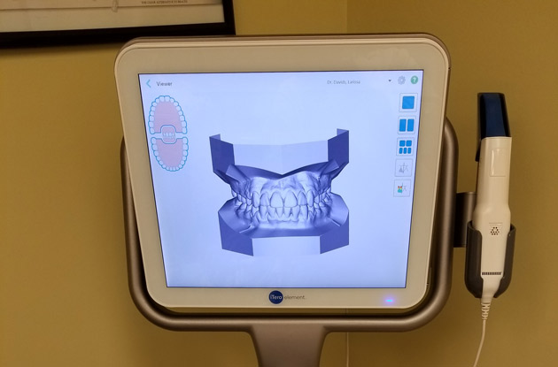 Rego Park Orthodontics Updates Dental Impression Scanner Technology